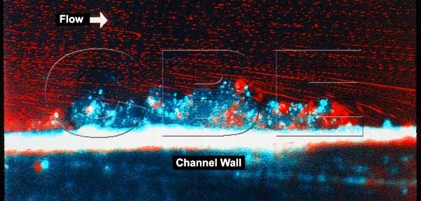 Sagittal view of biofilm