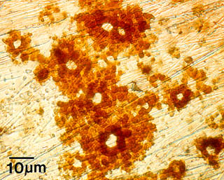 Pitting corrosion Pitting corrosion